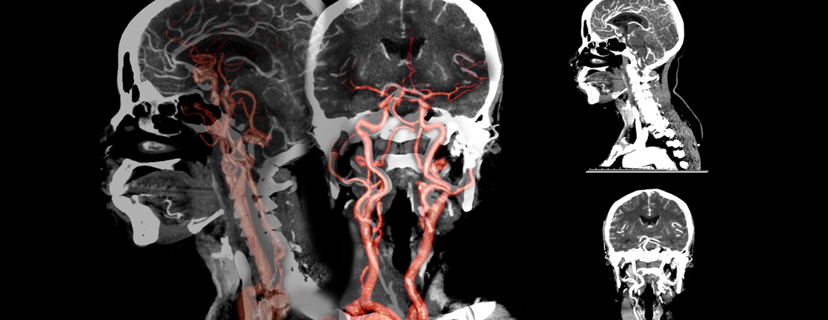 Cover Image for Fluoroscopy & Angiography