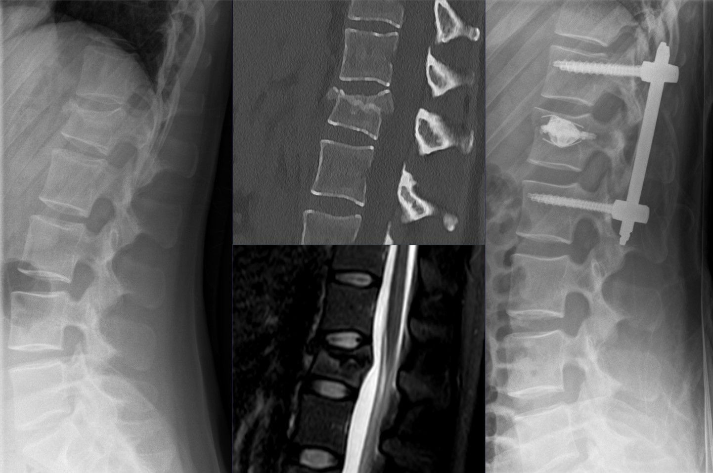 Cover Image for Back & Vertebral Column Radiology