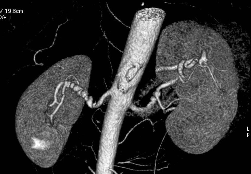 Cover Image for Kidney & Retroperitoneum