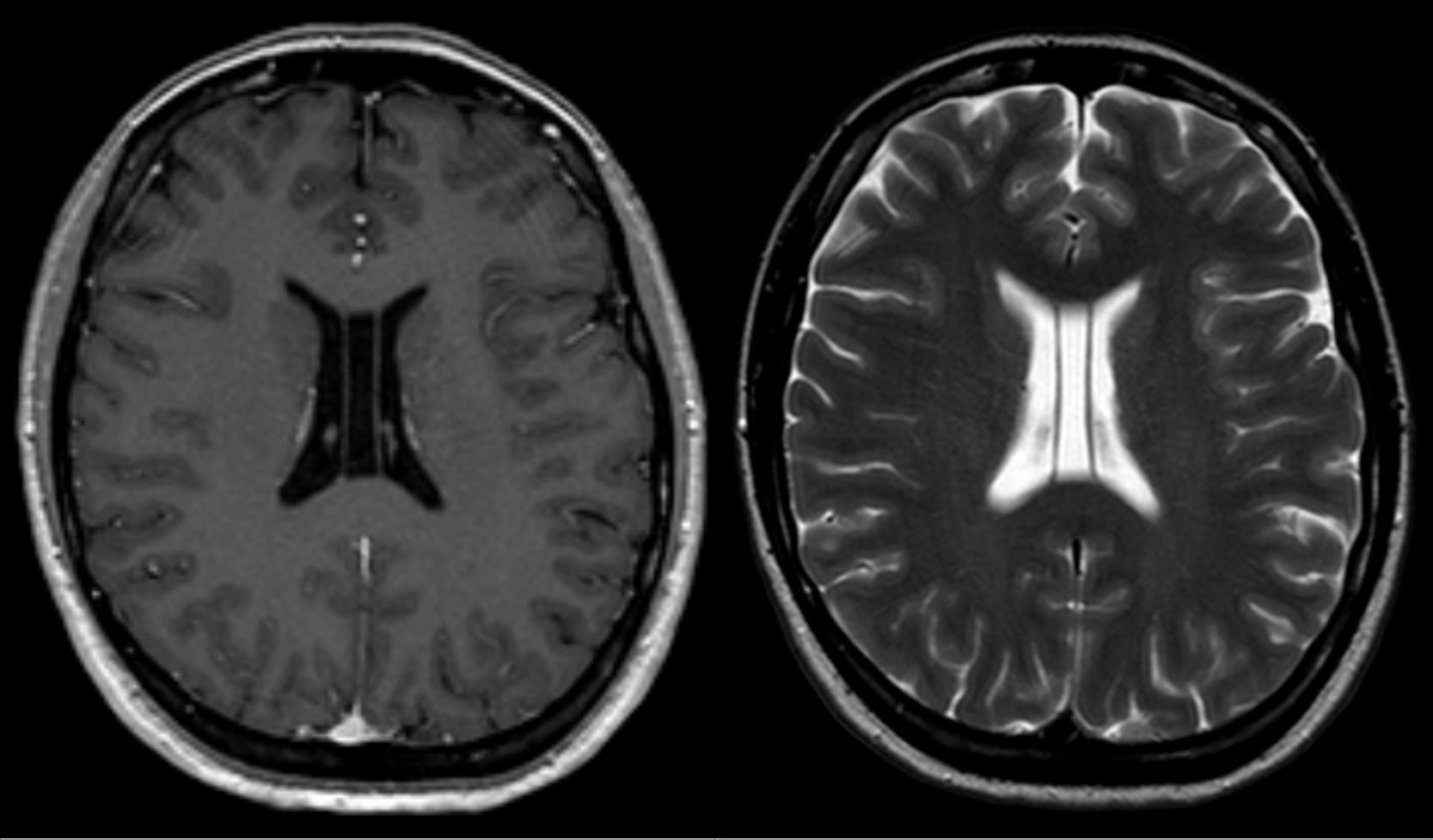 Cover Image for Magnetic Resonance Imaging