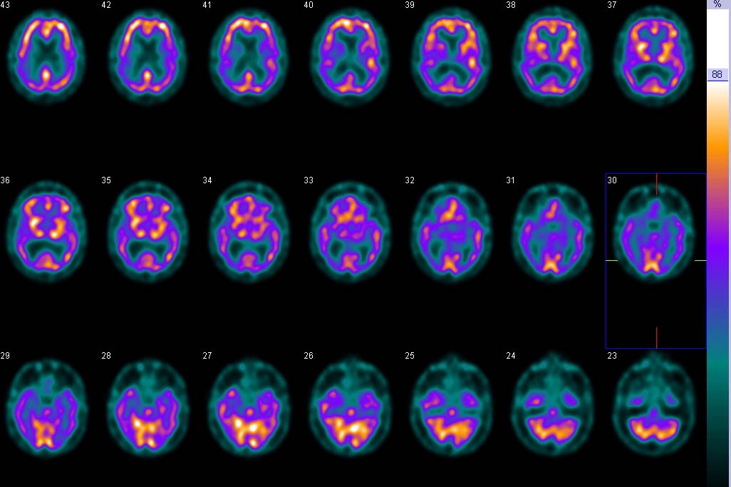 Cover Image for Nuclear Medicine